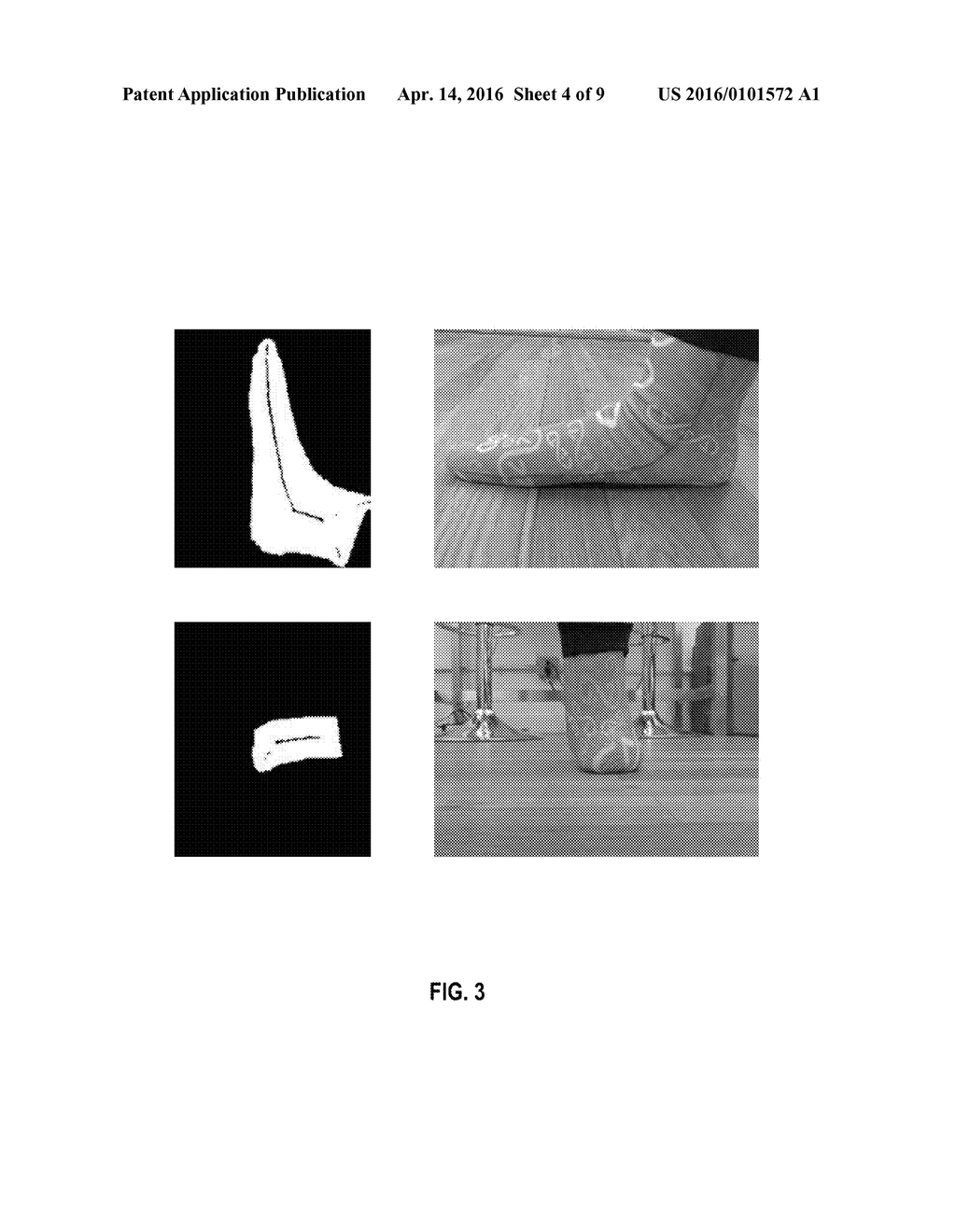 SYSTEMS AND METHODS FOR GENERATING A PATTERNED ORTHOTIC DEVICE - diagram, schematic, and image 05