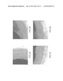 ISOLATION AND CULTIVATION OF STEM/PROGENITOR CELLS FROM THE AMNIOTIC     MEMBRANE OF UMBILICAL CORD AND USES OF CELLS DIFFERENTIATED THEREFROM diagram and image