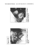 ISOLATION AND CULTIVATION OF STEM/PROGENITOR CELLS FROM THE AMNIOTIC     MEMBRANE OF UMBILICAL CORD AND USES OF CELLS DIFFERENTIATED THEREFROM diagram and image