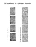 ISOLATION AND CULTIVATION OF STEM/PROGENITOR CELLS FROM THE AMNIOTIC     MEMBRANE OF UMBILICAL CORD AND USES OF CELLS DIFFERENTIATED THEREFROM diagram and image