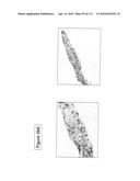 ISOLATION AND CULTIVATION OF STEM/PROGENITOR CELLS FROM THE AMNIOTIC     MEMBRANE OF UMBILICAL CORD AND USES OF CELLS DIFFERENTIATED THEREFROM diagram and image