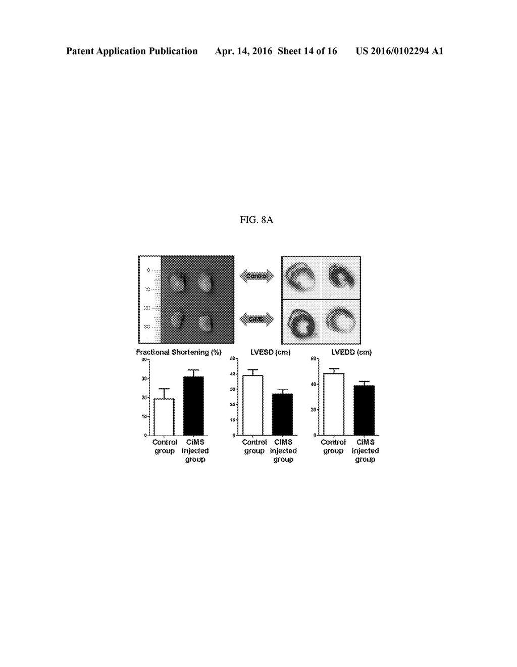 ENDOCARDIUM-DERIVED ADULT STEM CELLS AND METHOD FOR PRODUCING SAME - diagram, schematic, and image 15