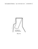 DETERMINATION OF ULTRASONIC INSPECTABILITY diagram and image