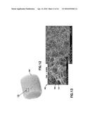 Blood Sample Management Using Open Cell Foam diagram and image