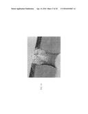 Chemical Functionalization of Solid-State Nanopores and Nanopore Arrays     and Applications Thereof diagram and image