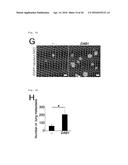 METHOD FOR DETERMINING PROGNOSIS OF CANCER diagram and image