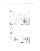 METHOD FOR DETERMINING PROGNOSIS OF CANCER diagram and image