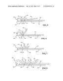 ARRANGEMENT AND METHOD FOR CONNECTING AN ELECTRICAL COMPONENT TO A     LEADFRAME diagram and image