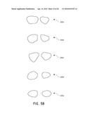 METHOD AND APPARATUS FOR DESIGN AND FABRICATION OF CUSTOMIZED EYEWEAR diagram and image