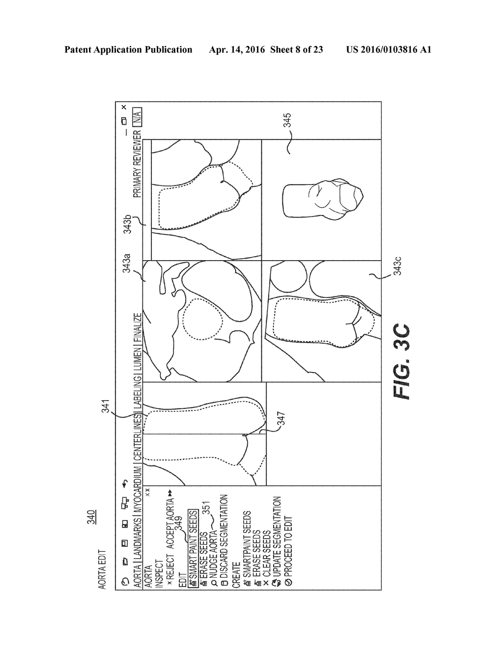 SYSTEMS AND METHODS FOR VALIDATING AND CORRECTING AUTOMATED MEDICAL IMAGE     ANNOTATIONS - diagram, schematic, and image 09