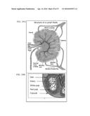 MULTI-SCALE COMPLEX SYSTEMS TRANSDISCIPLINARY ANALYSIS OF RESPONSE TO     THERAPY diagram and image