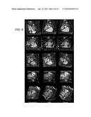 METHOD AND SYSTEM FOR  PUSH-BUTTON  COMPREHENSIVE CARDIAC MR EXAMINATION     USING CONTINUOUS SELF-GATED 3D RADIAL IMAGING diagram and image