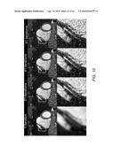 METHOD AND SYSTEM FOR  PUSH-BUTTON  COMPREHENSIVE CARDIAC MR EXAMINATION     USING CONTINUOUS SELF-GATED 3D RADIAL IMAGING diagram and image