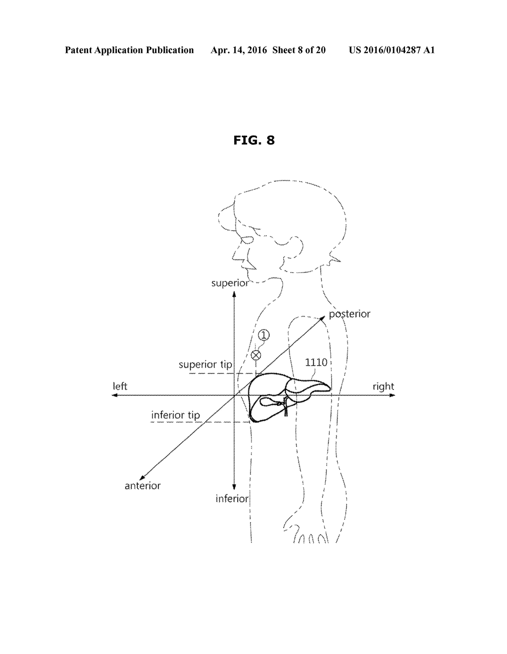 IMAGE PROCESSING APPARATUS, METHOD OF CONTROLLING IMAGE PROCESSING     APPARATUS AND MEDICAL IMAGING APPARATUS - diagram, schematic, and image 09