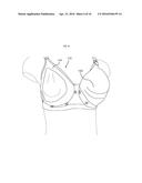 Adaptable nursing bra diagram and image