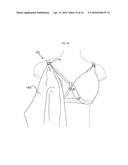 Adaptable nursing bra diagram and image