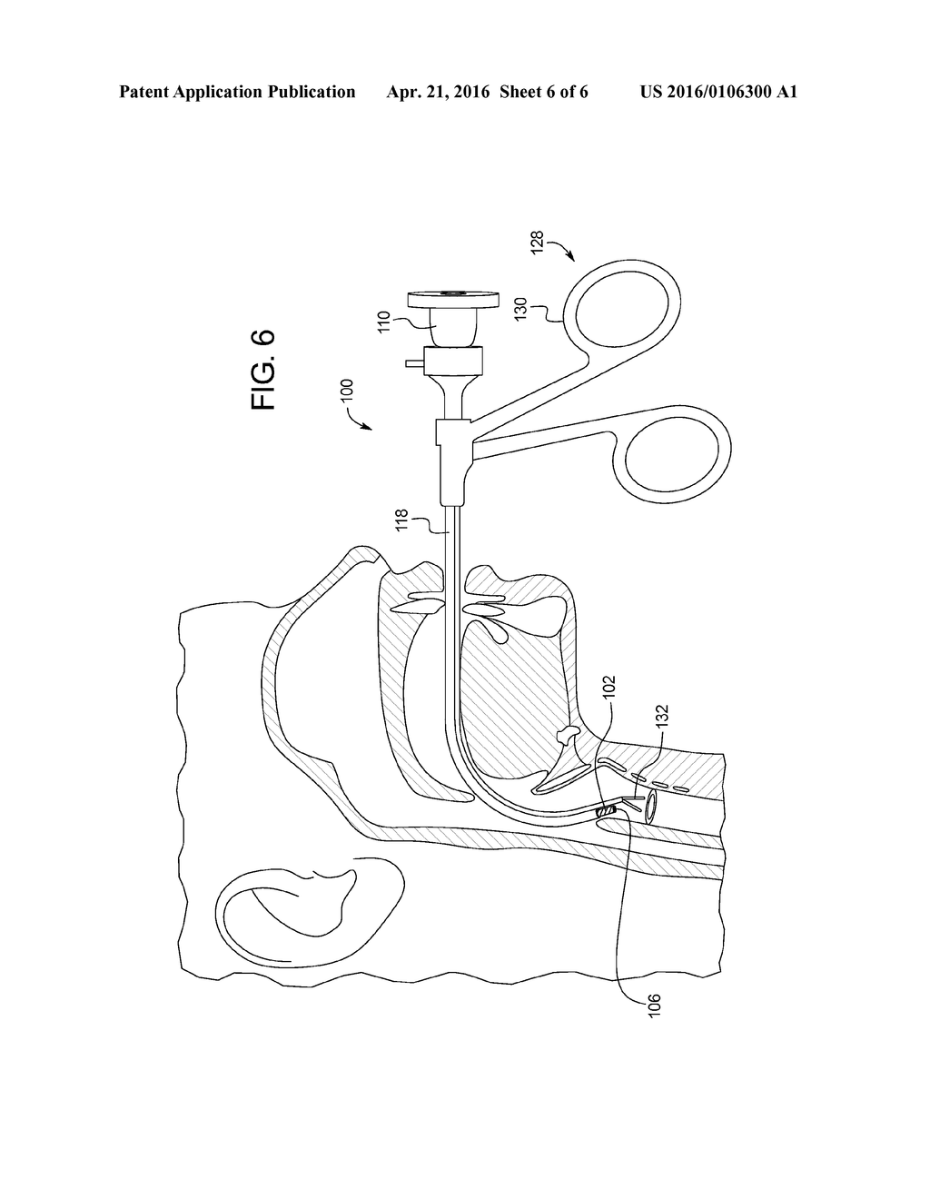 Flexible Endoscopic Exoskeleton Surgical System - diagram, schematic, and image 07