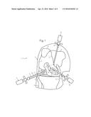 ATRAUMATIC ARTHROSCOPIC INSTRUMENT SHEATH AND METHOD diagram and image