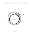 IMAGING SYSTEM PRODUCING MULTIPLE REGISTERED IMAGES OF A BODY LUMEN diagram and image