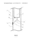 IMAGING SYSTEM PRODUCING MULTIPLE REGISTERED IMAGES OF A BODY LUMEN diagram and image