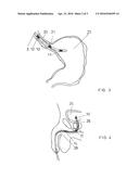 SPHINCTER TEST CATHETER diagram and image