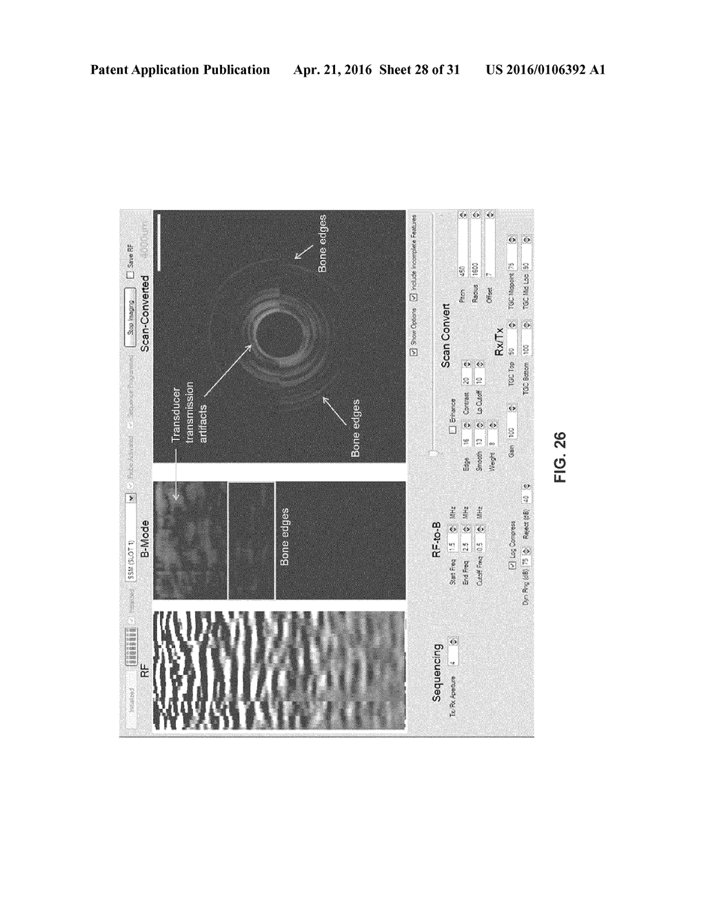 ULTRASONIC ARRAY FOR BONE SONOGRAPHY - diagram, schematic, and image 29