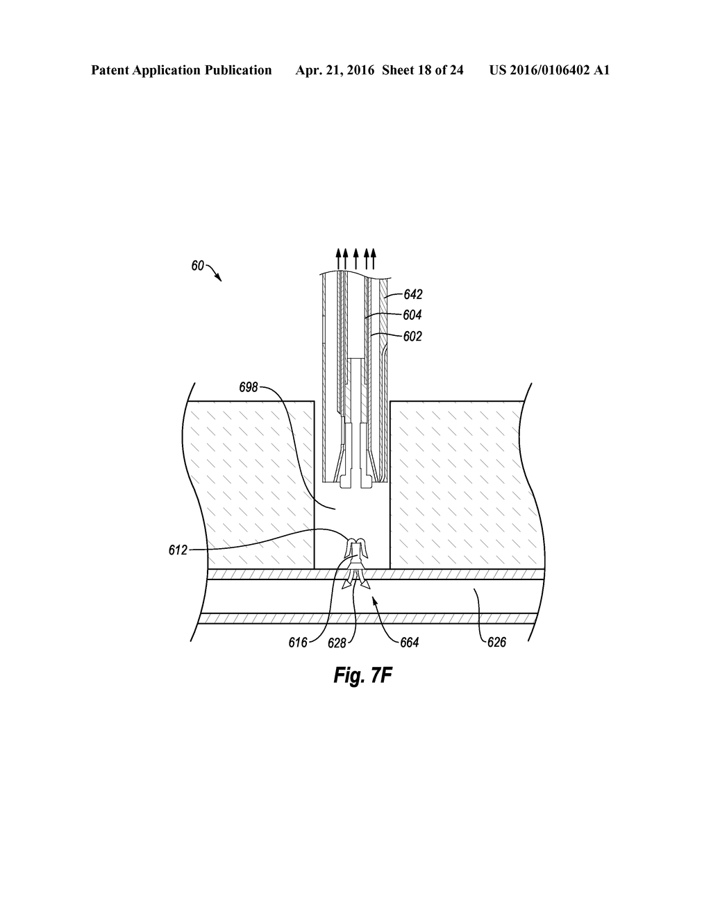 SUTURE SECURING SYSTEMS, DEVICES AND METHODS - diagram, schematic, and image 19