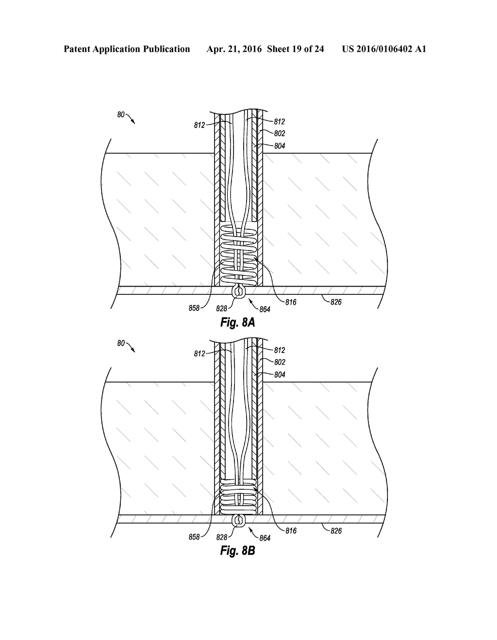 SUTURE SECURING SYSTEMS, DEVICES AND METHODS - diagram, schematic, and image 20