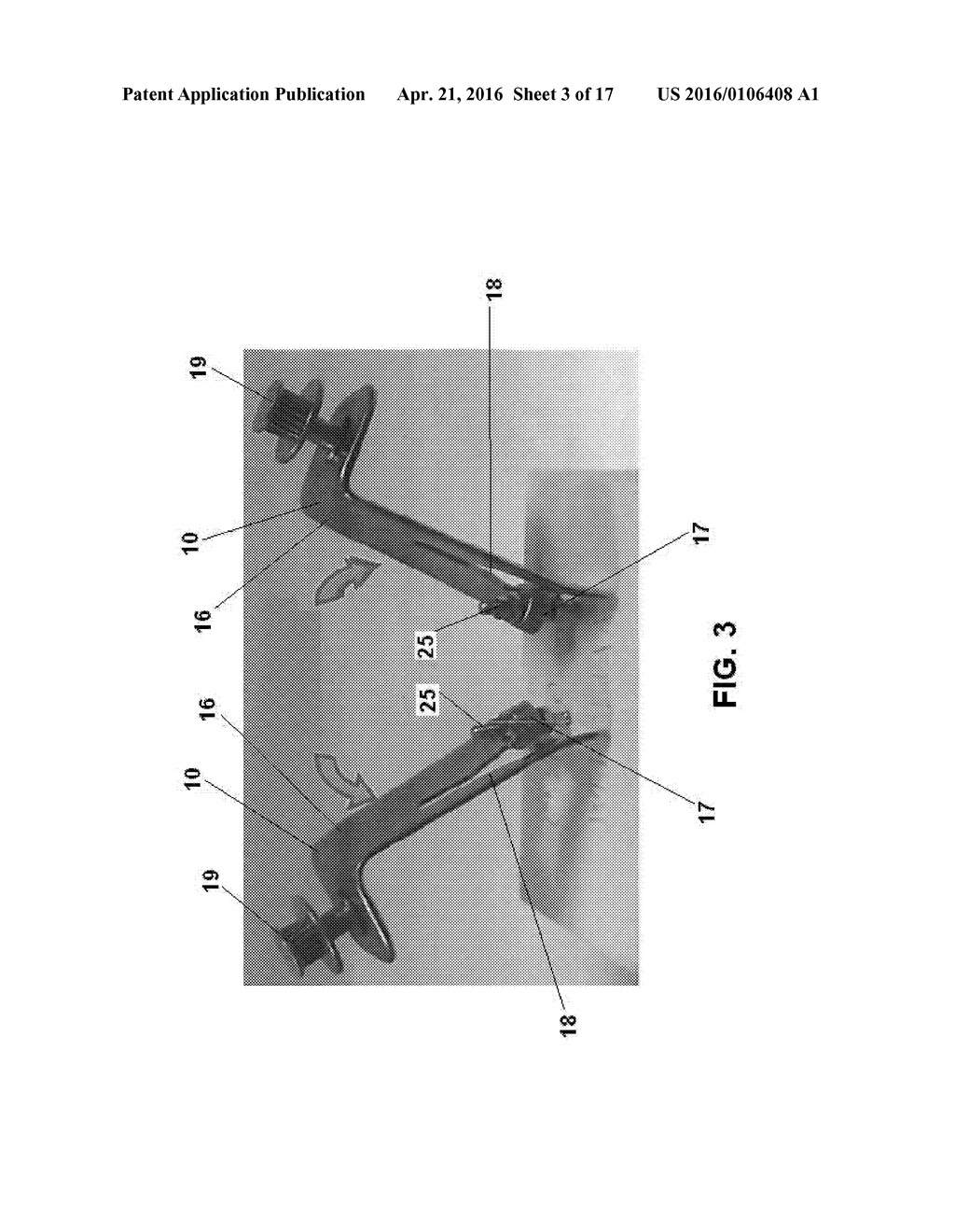 Orthopedic Tools for Implantation - diagram, schematic, and image 04