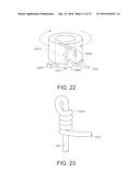 Suture Having a Restraining Element at an End and Method and Use Thereof diagram and image