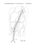 METHOD AND APPARATUS FOR COUPLING SOFT TISSUE TO A BONE diagram and image