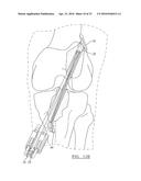 METHOD AND APPARATUS FOR COUPLING SOFT TISSUE TO A BONE diagram and image