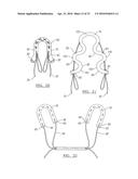 METHOD AND APPARATUS FOR COUPLING SOFT TISSUE TO A BONE diagram and image