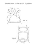 METHOD AND APPARATUS FOR COUPLING SOFT TISSUE TO A BONE diagram and image