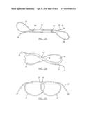 METHOD AND APPARATUS FOR COUPLING SOFT TISSUE TO A BONE diagram and image