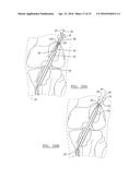 METHOD AND APPARATUS FOR COUPLING SOFT TISSUE TO A BONE diagram and image