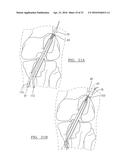 METHOD AND APPARATUS FOR COUPLING SOFT TISSUE TO A BONE diagram and image