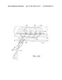 METHOD AND APPARATUS FOR COUPLING SOFT TISSUE TO A BONE diagram and image