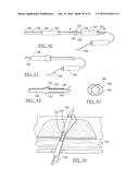 METHOD AND APPARATUS FOR COUPLING SOFT TISSUE TO A BONE diagram and image