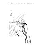 SUTURE STITCHES FOR CONTINUOUS SURGICAL SUTURING diagram and image