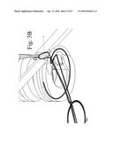 SUTURE STITCHES FOR CONTINUOUS SURGICAL SUTURING diagram and image