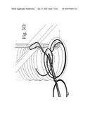 SUTURE STITCHES FOR CONTINUOUS SURGICAL SUTURING diagram and image