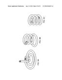 SUTURE STITCHES FOR CONTINUOUS SURGICAL SUTURING diagram and image