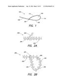 SYSTEMS AND METHOD FOR LEFT ATRIAL APPENDAGE OBLITERATION diagram and image