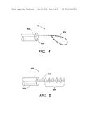 SYSTEMS AND METHOD FOR LEFT ATRIAL APPENDAGE OBLITERATION diagram and image