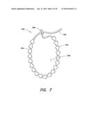 SYSTEMS AND METHOD FOR LEFT ATRIAL APPENDAGE OBLITERATION diagram and image