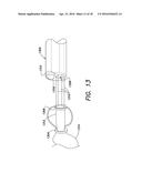 SYSTEMS AND METHOD FOR LEFT ATRIAL APPENDAGE OBLITERATION diagram and image