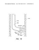 SYSTEMS AND METHOD FOR LEFT ATRIAL APPENDAGE OBLITERATION diagram and image