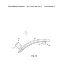 System for Articular Surface Replacement diagram and image