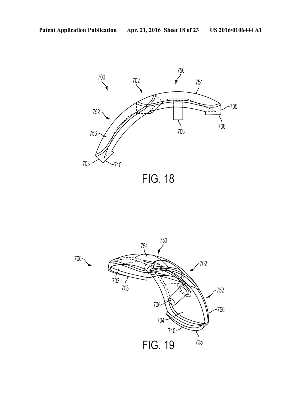 System for Articular Surface Replacement - diagram, schematic, and image 19